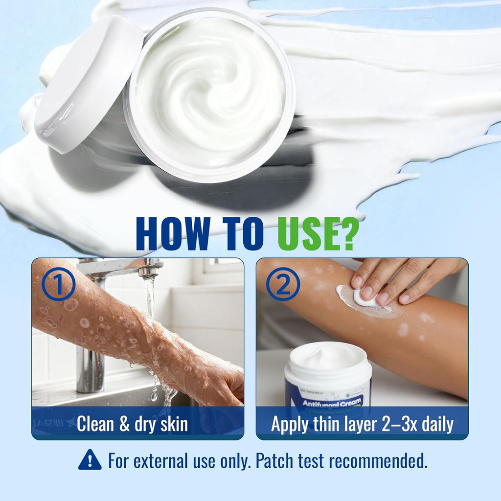 Antifungal Cream for Jock Itch: Anti Fungal Cream for Itchy Skin Relief Extra Strength - Ringworm Treatment for Humans - Athletes Foot Treatment for Feet 3.4 oz, 100g, White