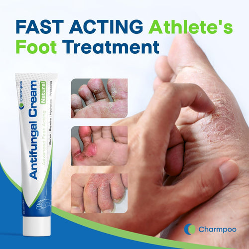 Antifungal Cream for Foot and Body: Fast Relief Athlete's Foot Jock Itch Psoriasis Ringworm Eczema Rashes - Powerful Herbal and Miconazole Formula 30g(Pack of 2)