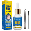 Toenail Fungus Treatment Extra Strength 30ml: Nail Cuticle Care Serum – Infused with Botanical Herbal Extracts for Clear Healthy-Looking Nails Lightweight Daily Nail & Toe Care